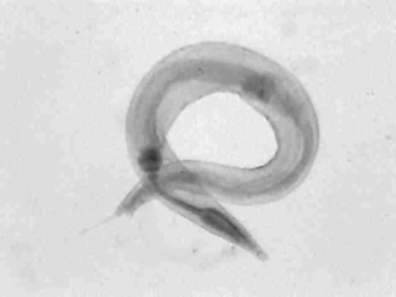 pinworm.JPG