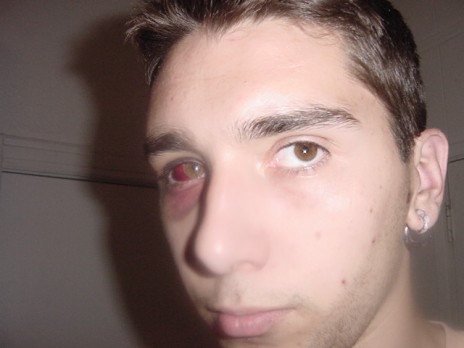 Looks_Like_Pain.jpg