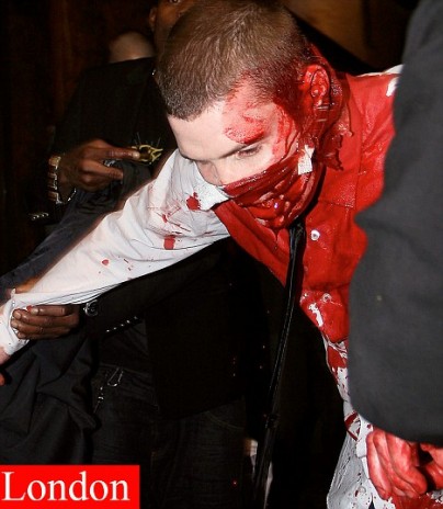 bloody.jpg