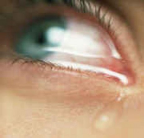 eye_crying.jpg