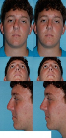 preop1.JPG