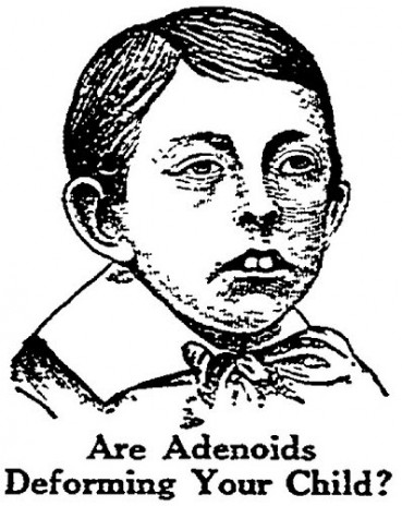 adenoids.jpeg
