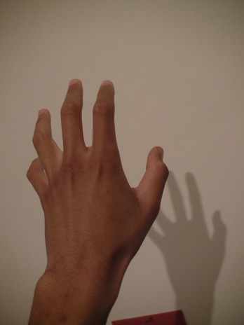 Palm_back.JPG