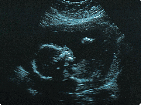 Baby_pic.gif