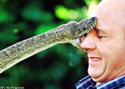 120106_snake_bite.jpg