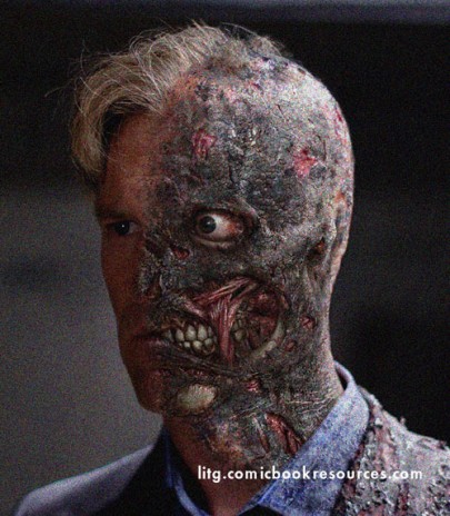 DentBurn.jpg