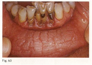 teeth.jpg